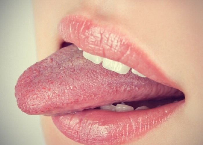 Признак заболевания