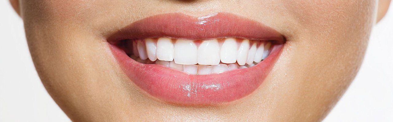 Отбеливания зубов