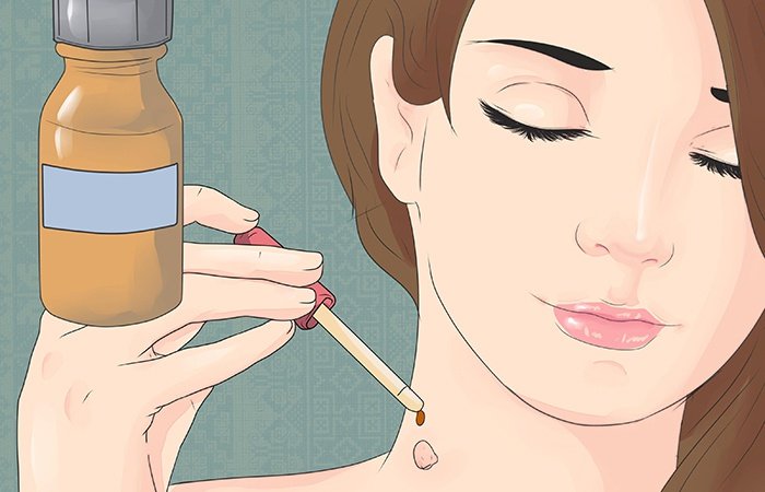 Масло чайного дерева от папиллом