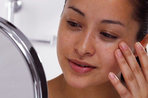 Лечение пигментных пятен