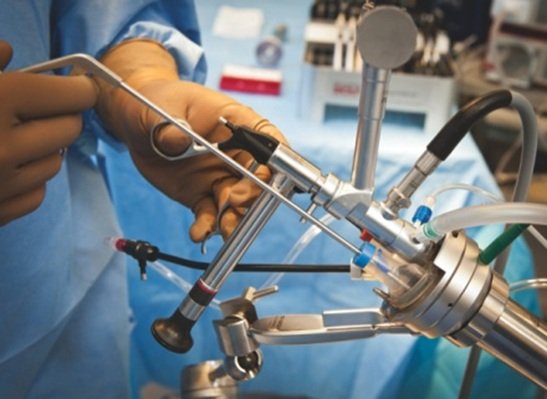 Эндоскопическая операция