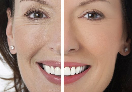 До и после применение масла