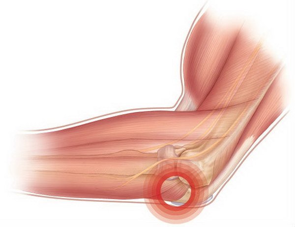 Боль из-за опорно-двигательного аппарата