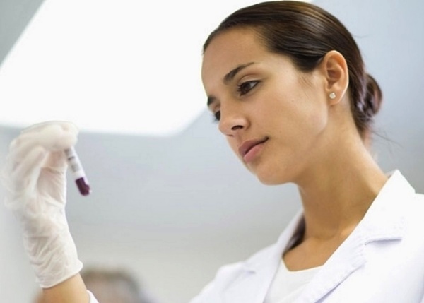 Уровень ТТГ в крови