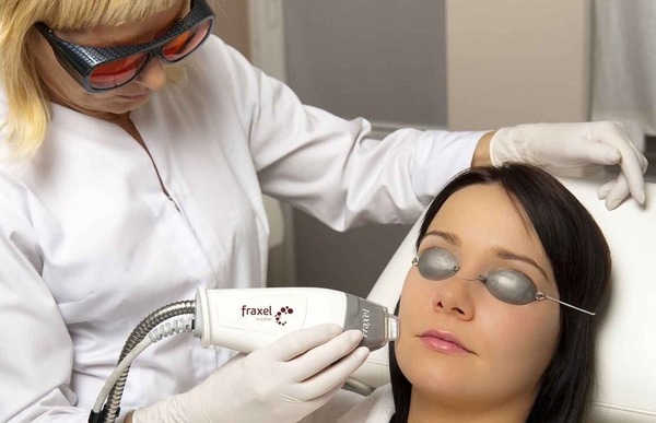 Лечение прыщей