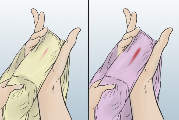 Имплантационное кровотечение