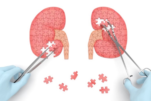 Заболевание почек