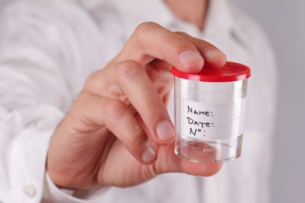 Баночка для сбора мочи