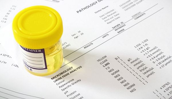 Расшифровка анализа мочи