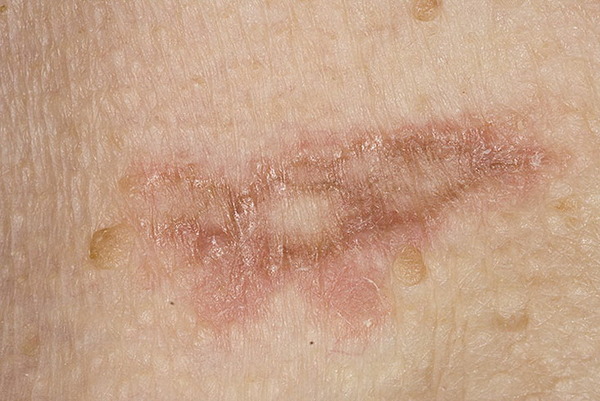 Изменение кожи