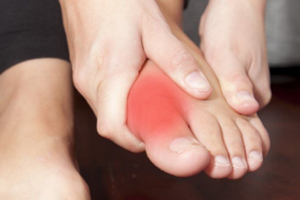 Воспаление сустава пальца ноги