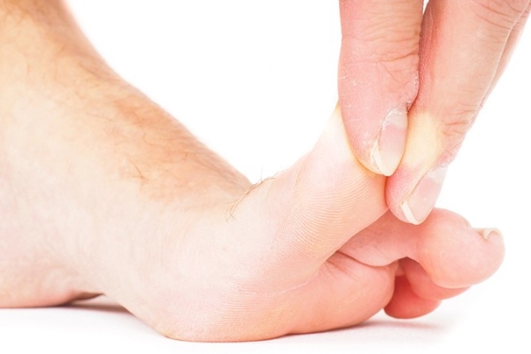 Ушиб большого пальца