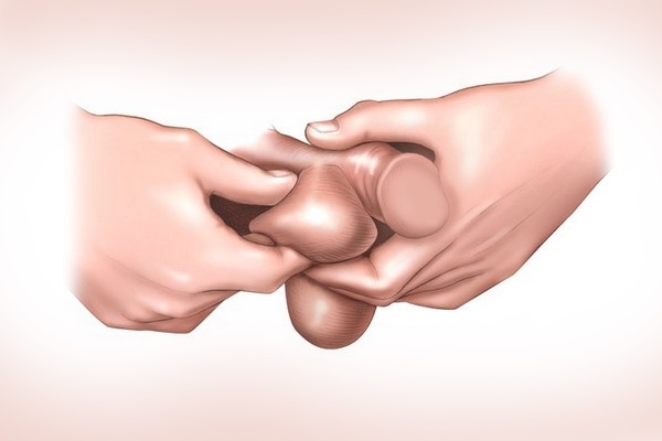 Самообследование на наличие опухолей мошонки