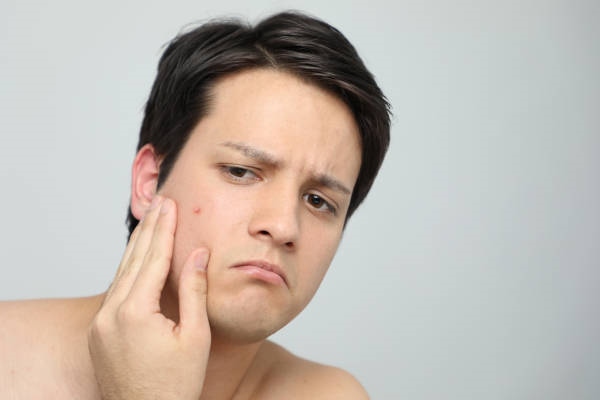 Прыщ на щеке