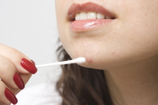 Обработка прыщей салициловой кислотой