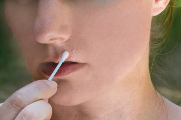 Обработка прыщей синтомициновой мазью