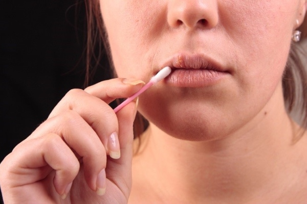 Лечение высыпаний на губах