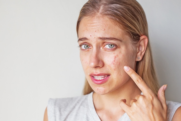 прыщи у беременной