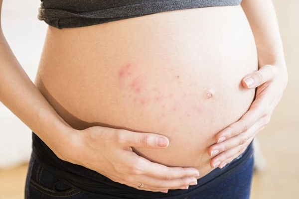 Прыщи на животе у беременной
