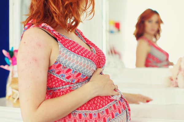 Прыщи на теле у беременной