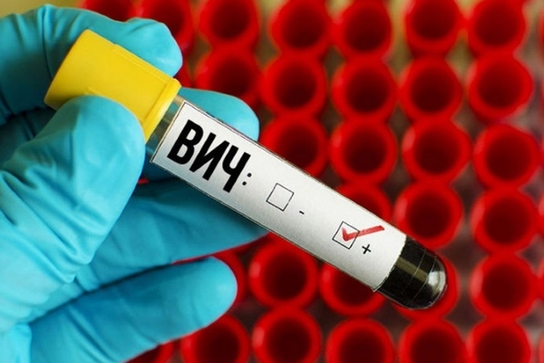 Развитие ВИЧ