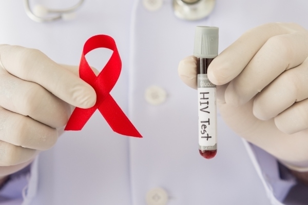 Длительность жизни при ВИЧ