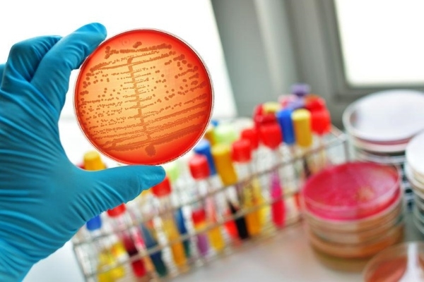 Диагностика стафилококковой инфекции