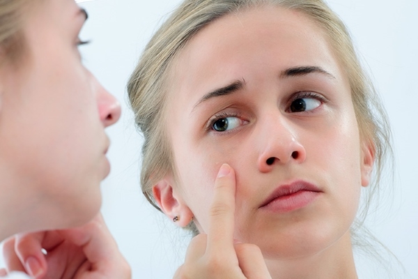 Прыщи у подростков