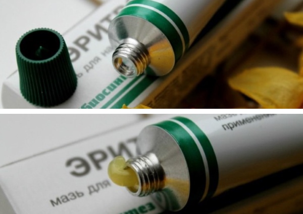 Использование эритромициновой мази