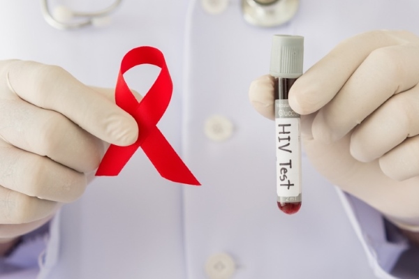 Тест на ВИЧ