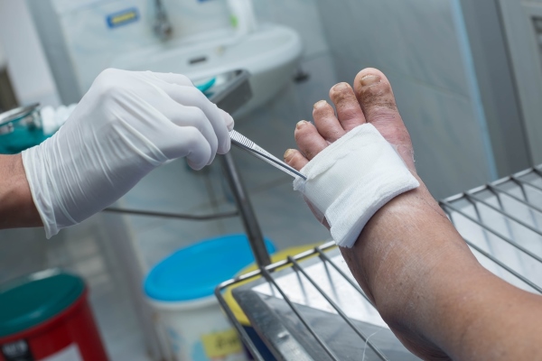 Гнилостная инфекция в ране