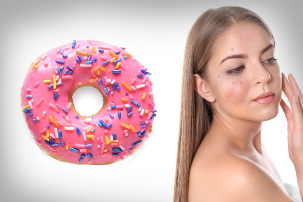 Прыщи на лице от сладкого