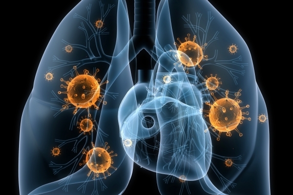 Легкие и туберкулез