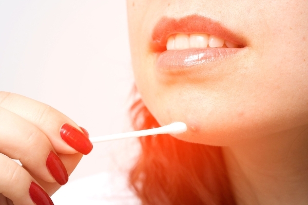 Точечная обработка прыщей