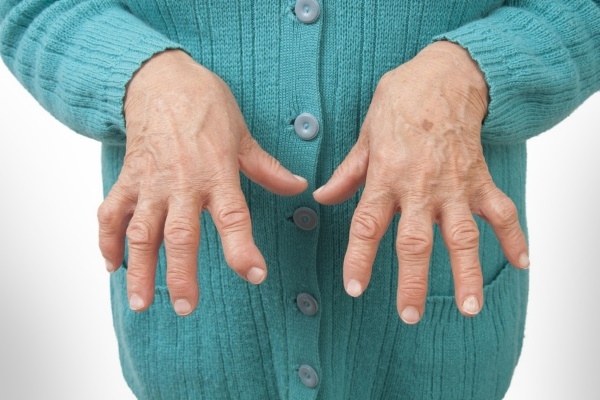 Деформирующий артрит