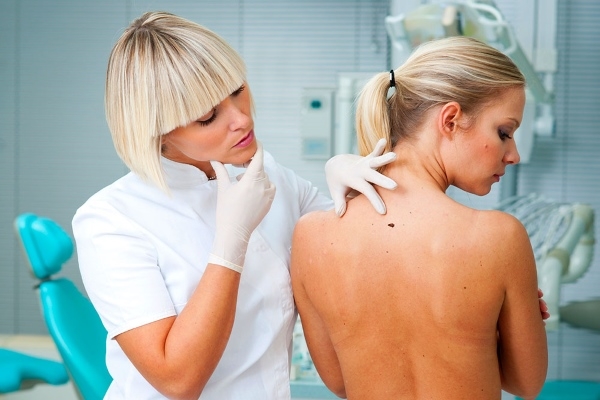 Прыщ на родинке