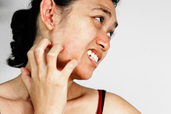 Чешется лицо и шея