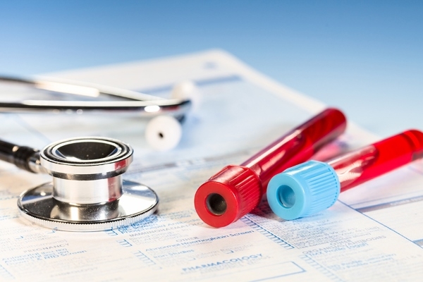 Диагностика ревматоидного артрита