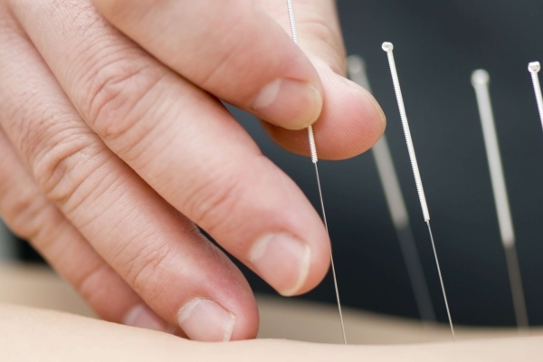 Иглоукалывание от ревматоидного артрита