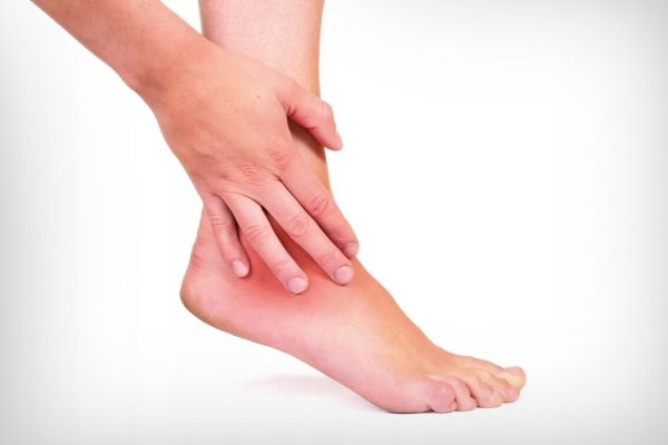 Симптомы артрита голеностопного сустава