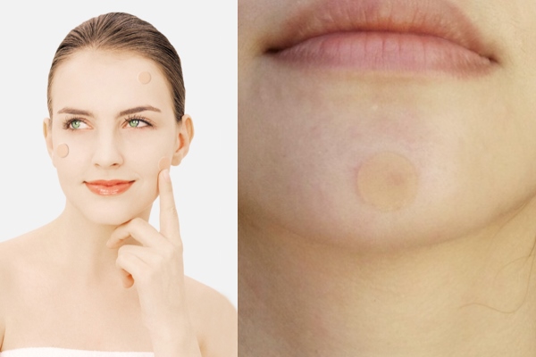 Пластырь от прыщей