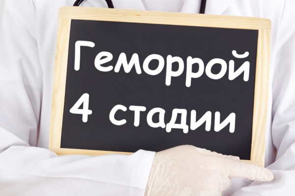 Геморрой 4 степени