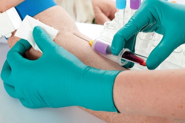 Диагностика геморроя